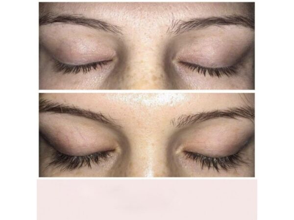 Hairplus X10Lash Kaş ve Kirpik Serumu